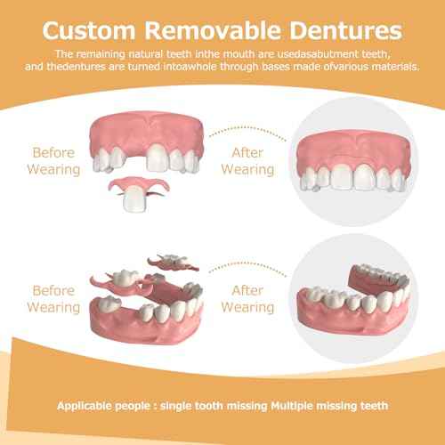 Partial Dentures - Dentures for Missing Teeth & Gaps - Lightweight & Unbreakable Replacement Teeth for Men & Women (1 Tooth)