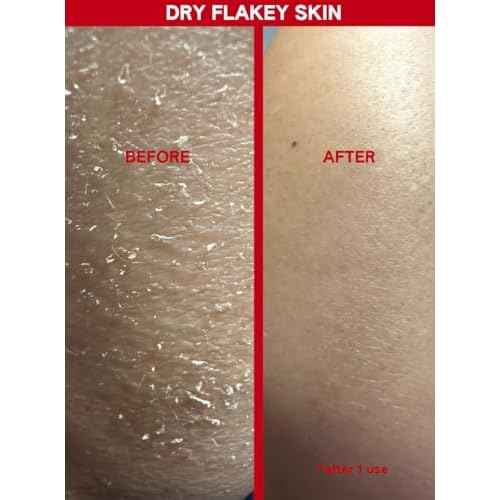 Chemical Body Exfoliant ? 30% AHA + 2% BHA Pre-Shower Body Mask for Smooth, Radiant Skin, Dead Cell Removal & Soft Texture, Glycolic & Salicylic Acid, 150ml