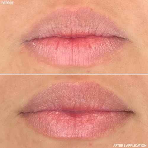 RescueMD Restorative Lip Treatment, Peptide-Powered Rejuvenation + Arnica Repair for Healthy, Hydrated Lips (12mL)