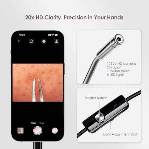 Luma 1 Visual Blackhead Remover Tweezers with Camera - Pimple Popper Tool with Camera 20x Magnification, 1080P, 8 LED Lights, with Blackhead Remover Pimple Popper Tool Kit (6 Piece Kit)