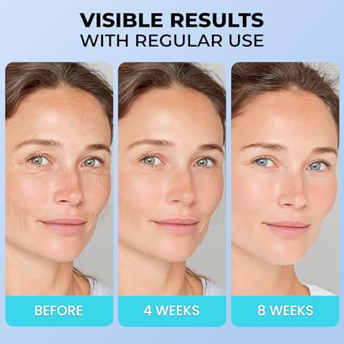 Face Moisturizer for Aging Skin: Wrinkle Cream for Older Women and Men 50 and 60 plus with Retinol, Collagen and Hyaluronic Acid ? Facial Moisturizer for Mature Skin, 1.7 fl. Oz (Medium, Unscented)