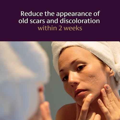 Mederma Scar Serum ? Triple-Action Formula with Vitamin E, Hyaluronic Acid & Niacinamide ? Clinically Shown to Reduce Old Scars, 1 Fl. Oz.
