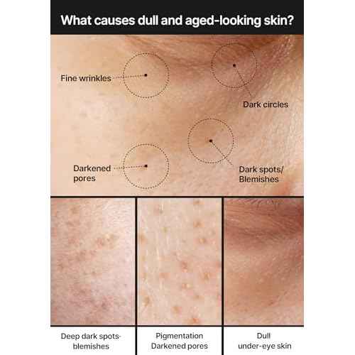 celimax Pore+Dark Spot Brightening Cream | with Niacinamide, Tranexamic Acid, TXA Cream, Pore Minimizer, Non-Irritating, Hydrating, For Sensitive Skin, 35ml