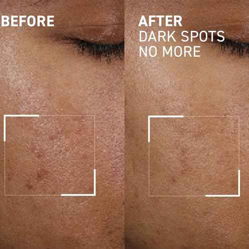 Dr. Brandt Bright This Way Dark Spots No More - Reduces Number, Intensity & Size of Pigmented Spots - 0.5 fl oz