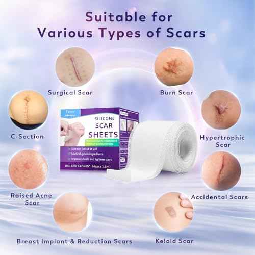 Silicone Scar Sheets, Silicone Scar Tape(1.6"x 60" Roll-1.5M), Medical Grade Scar Sheets, Scar Tape for Surgical Scars, Burn, C-Section, Keloid Scars, Acne Treatment, Stretch Marks Removal