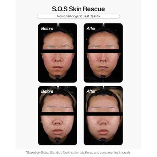 BETELCHLOROUS S.O.S Rescue Dose 30ml(1.014 fl.oz) ? Hypochlorous Acid Face Serum for Acne, Redness & Sensitive Skin ? Korean Skin care Calming Serum