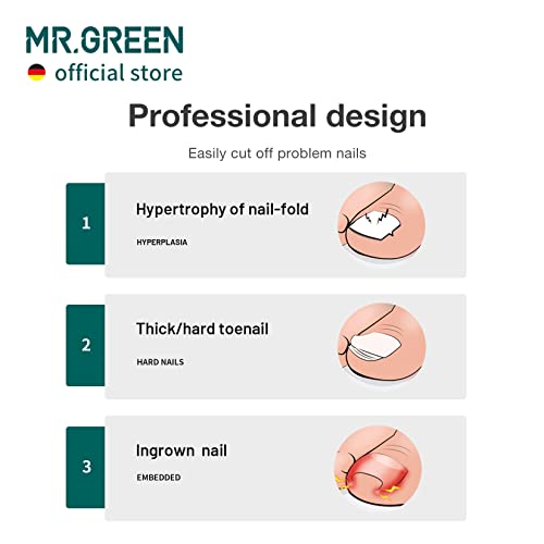 MR.GREEN Toenail Clippers Stainless Steel Ingrown Nail Cutter Thick and Hard Nails Pedicure Manicure Tools (Green+Nail Remover)