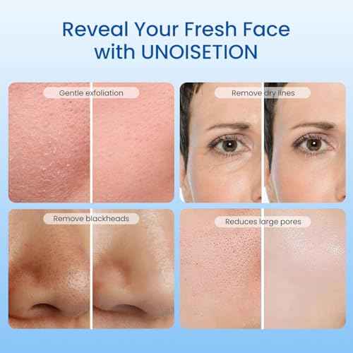 Diamond Microdermabrasion Machine, UNOISETION 3 in 1 Dermabrasion Facial Machine for Exfoliation & Blackhead Removal, Home Use Facial Skin Care Equipment