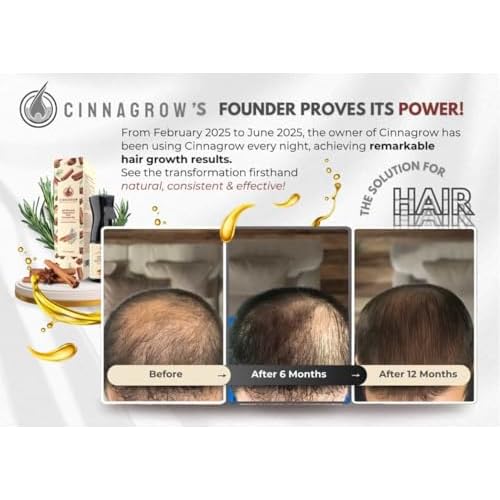 Hair Growth Oil with Rosemary & Cinnamon ? Thicker Hair, Scalp Nourishment & Strength ? Lightweight, Non-Greasy, Fast Absorbing Formula ? 60 ml (2 fl oz) Bottle with Pump Dispenser