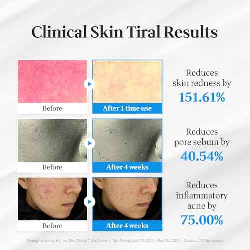 Cica Face Moisturizer with Pro-Vitamin B5 ? Daily Hydrating Cream for Dry and Delicate Skin ? With Panthenol, Squalane & Glycerin ? Lightweight Skin Barrier Support, Day & Night, 2.2 Fl Oz.