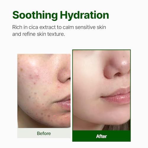NACIFIC CICA PDRN First Toner 5.07 fl oz 150ml, Centella Asiatica & PDRN for Sensitive Skin, Cooling Spot Toner, Balancing & Soothing Korean Skincare, Stocking Stuffers, Christmas Gifts for Women