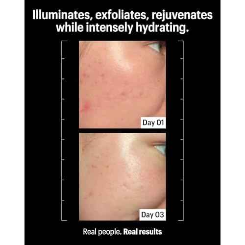 Allies of Skin Multi Acids & Retinoid Sleeping Facial | Exfoliating Overnight Glycolic Acid & AHA Peel | Resurfacing Anti-Aging Treatment For Fine Lines | Unclog Pores and Treat Blackheads 1.6 fl oz