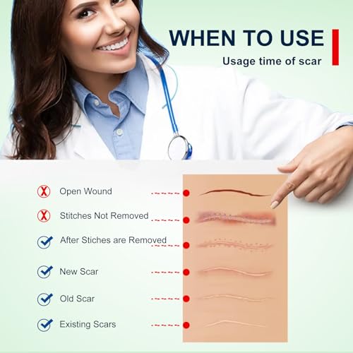Silicone Scar Sheets (1.6¡± x 120¡± Roll-3M), Silicone Scar Tape Roll, Scar Silicone Strips, Reusable, Professional Scar Removal Sheets for C-Section, Surgery, Burn, Keloid, Acne et