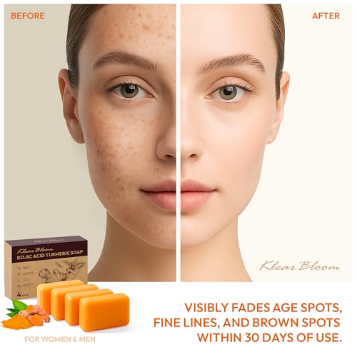 Kojic Acid Soap, Turmeric Soap Bar for Dark Spots Brightening & Moisturizing with Collagen, Vitamin E, Retinol, Hyaluronic Acid, Shea Butter, Paraben & Sulfate-Free 105g x4 Bars