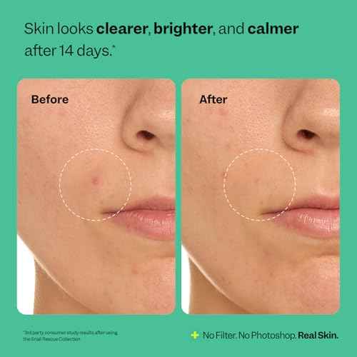Peach Slices - Snail Rescue Purifying Cleanser (4.05 oz) - Snail Mucin Concentrate - Cleanse & Refresh Skin - Pine Bark, Hyaluronic Acid & Cica - Vegan & Cruelty Free - Korean Skin Care & Beauty