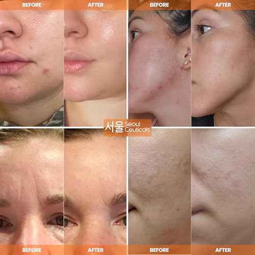 SeoulCeuticals Large 4oz 97.5% Snail Mucin Moisturizer Cream Korean Skin Care Day & Night Snail Repair for Face - K Beauty Anti Aging Facial Skincare