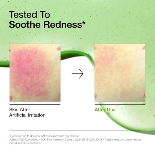 Anua Azelaic Acid 10 Hyaluron Redness Soothing Serum, Facial Serum for Troubled & Sensitive Skin, Breakouts, Hyaluronic Acid, Niacinamide, Spot Care, Natural Color, Korean Skincare (30ml/ 1.01 fl oz.)