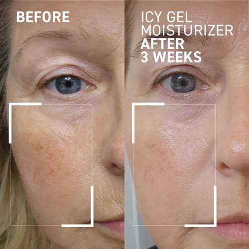 Dr. Brandt iD-STRESS Icy Gel Moisturizer - Revitalize Dull-Looking Skin for a Flawless, Dewy Complexion - 1.7 fl oz, Pack of 2