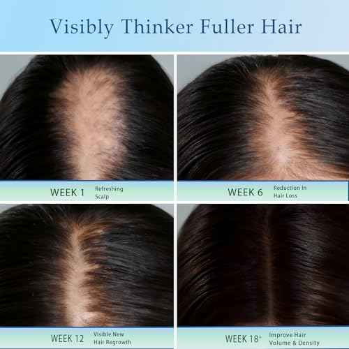 Rosemary Hair Growth Serum Roll On with 3% Rosemary£¬2% Ginger oil£¬3% Aloe Vera Extract£¬ Stronger Root£¬stimulate follicle,Hair Thicker£¬Hair Loss Treatment.Advanced Hair Regrowth,0.85 Fl Oz pcs
