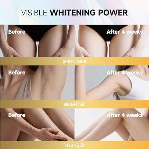 Skin Bleaching Cream - Vitamin C Dark Spot Remover for Underarms, Knees, Elbows & Bikini Line/whitening cream/skin bleach (50ml/1.69FL.OZ)