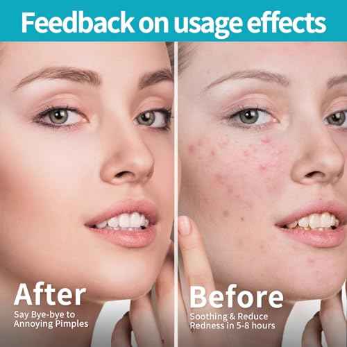 Pimple Patches for Face (648 Count),3 shapes (Round,Star and heart Shapes),Hydrocolloid Spot Dots with Salicylic Acid and Tea Tree Oil