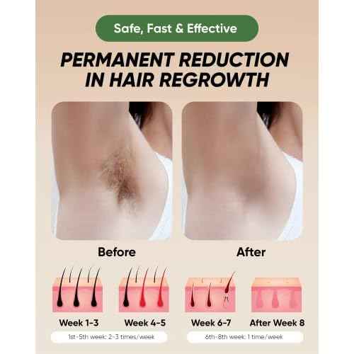 XSOUL At-Home IPL Hair Removal for Women and Men Permanent Hair Removal 999,999 Flashes Painless Hair Remover on Armpits Back Legs Arms Face Bikini Line, Corded