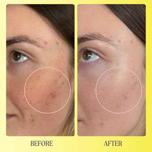 Kinship Brightwave Brightening 10% Vitamin C Serum for Face | Peptide Serum Dark Spot Corrector | Vegan Collagen Anti Aging Skincare | Smooth Fine Lines | Reduce Wrinkles (1 Fl Oz)