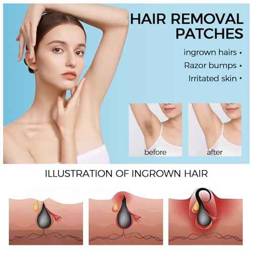 Ingrown Hair Patch, Ingrown Hair Treatment, Razor Bump Treatment for Bikini Area, Fast Ingrown Hair Pads Smooth Skin, Non-Irritating Formula for Women and Men,30 Count