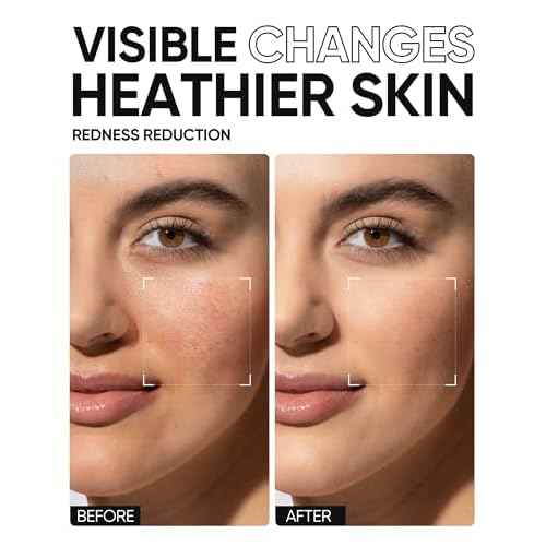 5X Ceramides Moisture Barrier Cream, Hydrating Skin Barrier Repair Face Moisturizer for All Skin Types with Hyaluronic Acid & Centella, Daily Moisturizer, Non-Comedogenic