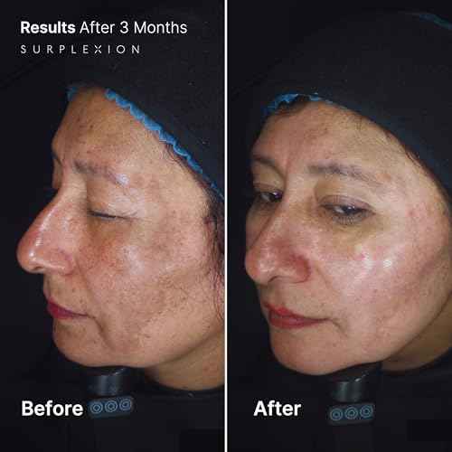 Moisturizer Code Plus, Extreme Face Moisturizer, Post-Treatment Recovery Formula, Lightweight Non-Comedogenic, Daily and Post-Procedure Use