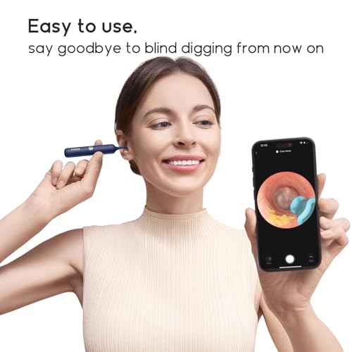 BEBIRD Official Original Accessory Only for Earsight Plus or R1 Ultra- 14 PCS Replacement Tip for Wet/Dry Wax Cleaning - Ear Spoons Accessories Set (New Spiral Structure!)