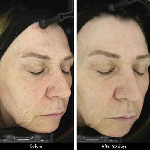 Snow Fox Omega Repair Cream with Plant-Based Omega-3-6-7-9 ? 50 ml