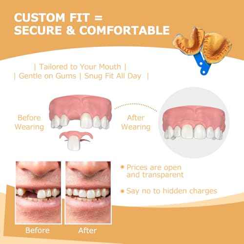 Partial Dentures - Dentures for Missing Teeth & Gaps - Lightweight & Unbreakable Replacement Teeth for Men & Women (1 Tooth)