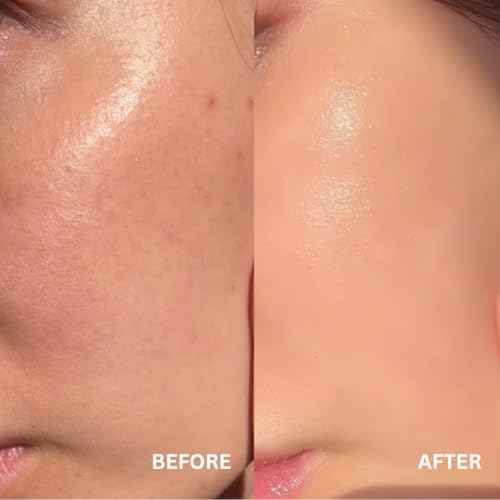 Anti-Aging Antioxidant Emulsion with Hyaluronic Acid, Vitamin C & E, Korean Taiwanese Skincare, Firming & Hydrating Face Lotion, Smooths Fine Lines & Wrinkles and Boosts Collagen Production