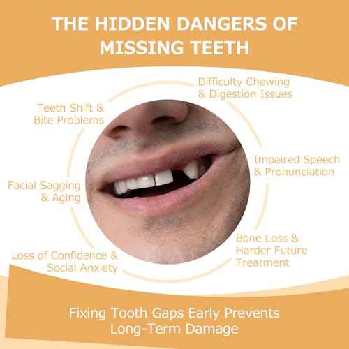 Partial Dentures - Dentures for Missing Teeth & Gaps - Lightweight & Unbreakable Replacement Teeth for Men & Women (1 Tooth)