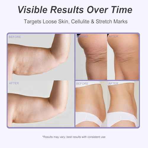 Get Dream Glow Overnight Toning Whip Cream ? LIFTONIN¢ç Skin Tightening, Firming & Anti-Cellulite Cream for Body, Booty, Thighs, Belly & Arms ? Includes Satin Eye Mask, 3.38 ounces