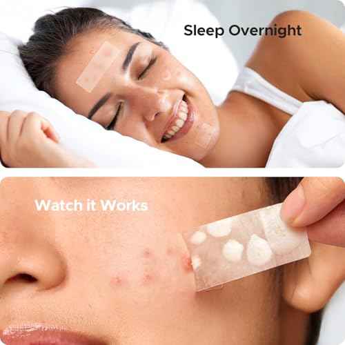 TKTK Large Pimple Patches for Face, 7 Sizes XL Acne Patches, Big Hydrocolloid Bandages for Body, Chin, Forehead, Chest, Back Zit Breakouts, Hydrocolloid Patch (Strip, Square, Dot 126 Count)
