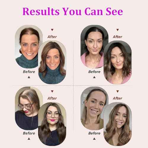 Hair Toppers for Women Real Human Hair, Light Grey 14 Inch 360¡Æ Cover Middle Part Topper for Women with Thinning Hair Realistic Scalp Line 4x4.8 Inch Upgrade Basement HairPieces