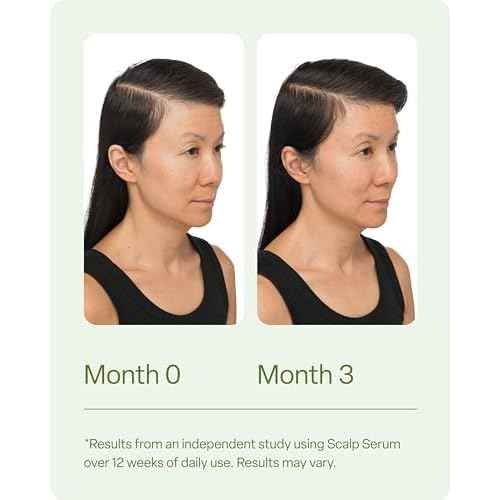 Divi Scalp Serum for Thinning Hair Clinically Tested, Non-Greasy Formula with Amino Acids, Caffeine & Rosemary Oil Promotes Healthy Scalp & Fuller-Looking Hair, Reduces Oil & Product Buildup