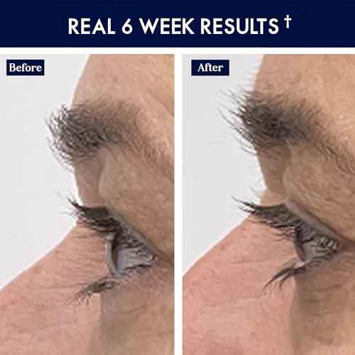 SugarbearPRO LashCare Vitamin Serum with Peptides MSM and Biotin | Vegan Formula | 3 Month Supply for Fuller Healthier Looking Lashes