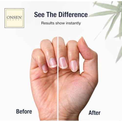 Onsen Nail & Cuticle Cream Treatment w/Japanese Tsubaki, Jojoba & Lavender Oil, Shea Butter ? Strengthens Nails, Softens Cuticles - Daily Repair Care (2 Count/15 ml)
