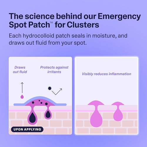 Curology Emergency Spot Patch Clusters for Breakouts, Stocking Stuffer Gifts, Fast Acting Large Hydrocolloid Pimple Patches for Face, Oil Absorbing, 14 Count