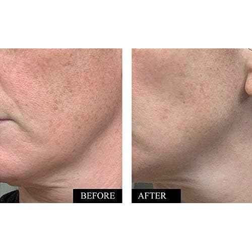 Vitamin C Serum for Face | Brightening & Anti Aging Serum for Men & Women | With Hyaluronic Acid, Vitamin E, Aloe & Jojoba | Dark Spot & Wrinkle Reducer | Made in USA | 1.7 oz | 2 Pack