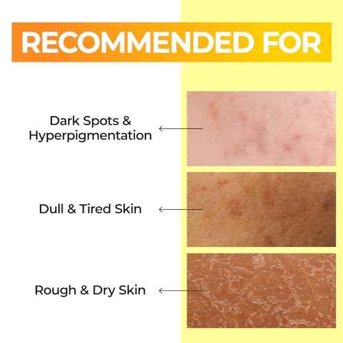 numbuzin No.5 Toner | Vitamin Boosting Essential Toner | First Step Skin Care | Improves Hyperpigmentation and Uneven Skin Tone | 6.76 fl. oz.