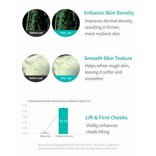 REJURAN¢ç Turnover Ampoule, c-PDRN¢ç [Larger Size] - Original Salmon DNA PDRN Face Serum for Rejuvenation, Firming, Hydration & Youthful Glow, Smooths Skin Texture. Korean Skincare (1.69 fl oz)