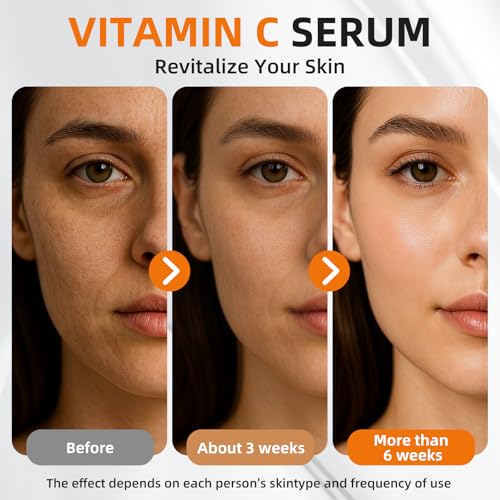 Super 22% Vitamin C Retinol Serum for Face: Advance Anti-Aging & Brightening Formula with Hyaluronic Acid, Niacinamide, Collagen, Peptides - Hydrates, Smooths, Targets Age Spots, Wrinkles, 1.7 Fl Oz
