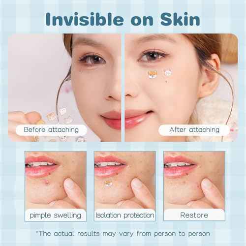 VENROCK Pimple Patches for face,24 Cute Pet Shapes 48 Count Hydrocolloid Acne Treatment for Covering Zits & Blemishes Spot for Kids & Adults, with Salicylic Acid, Tea Tree Oil, Centella Asiatica Oil