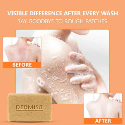 Dermis 8 Natural Carrot Soap Bar ? Brightening & Nourishing Face & Body Soap ? Made with Carrot Extract, Jojoba & Camellia Oils (200g x 6 Pack)