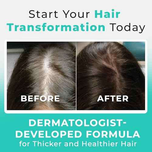 Hair Plus MD Hair Growth Supplement, 120 Capsules ? Supports Hair Growth & Density ? Dermatologist-Developed with Collagen & Vitamins ? Gluten-Free, Toxin-Free, Non-GMO ? 1 Month Supply