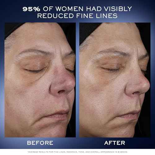 Lanc?me G?nifique Ultimate Dual Recovery Face Serum- Anti-Aging Serum Visibly Improves Fine Lines, Rough Texture, Plumpness and Even Skintone - with Beta Glucan and, Hyaluronic Acid